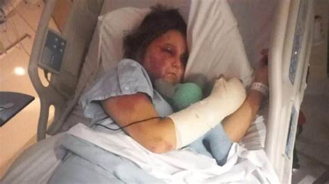 kiira hart|Kirra Hart’s story — Her brutal attack explained